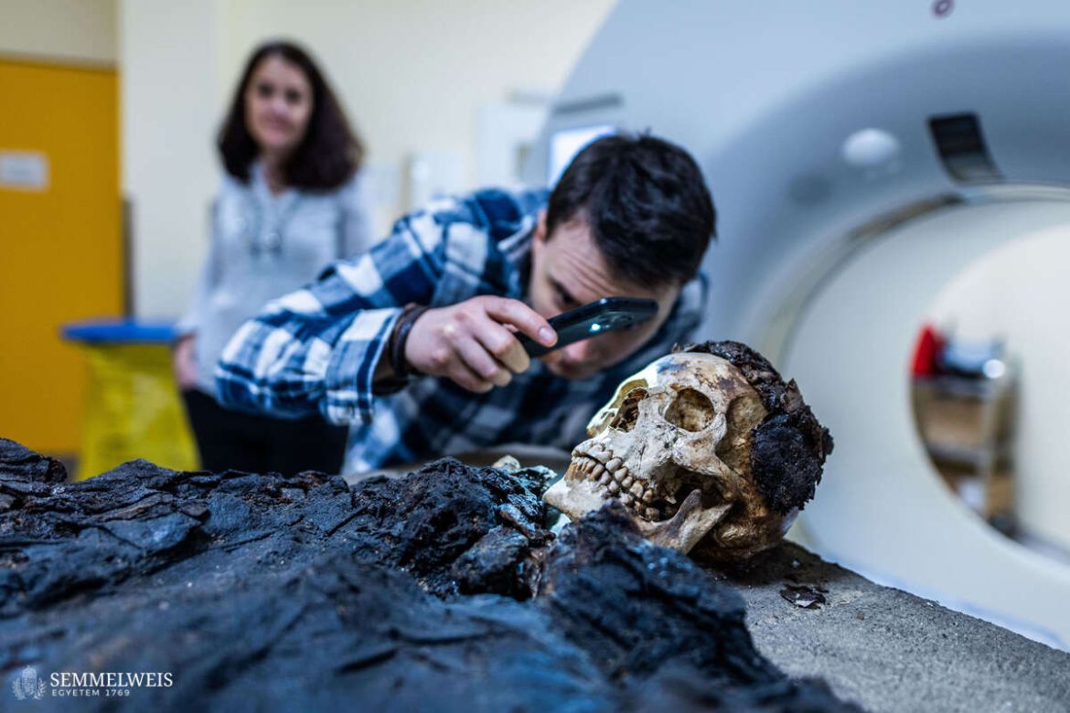 Fotó: Barta Bálint, Semmelweis Egyetem