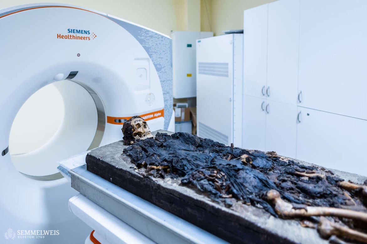 Fotó: Barta Bálint, Semmelweis Egyetem